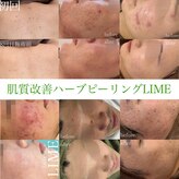 ライム 錦糸町(LIME)