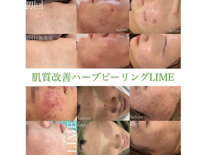 ライム 錦糸町(LIME)の写真