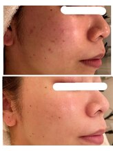 ジェニックサロン グランドギンザ ひたちなか(GENIC SALON GRAND GINZA)/ 日本一の肌改善サロンの実力