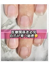 スターネイル(Starnail)/スター式ネイルケア二枚爪/深爪
