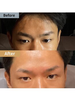 眉毛ハウス 吉祥寺店(眉毛HOUSE)/お客様の施術例(吉祥寺/東京)