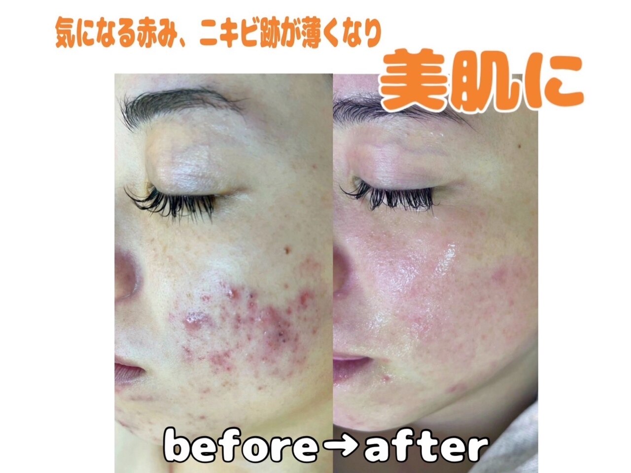 パールプラス 呉店｜ホットペッパービューティー