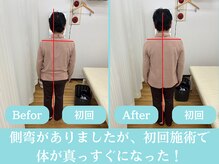 さいとう整骨院/背骨の歪みもお任せください！