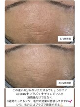 エミニー(Eminy)/プラズマ効果