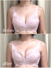 エヌエー(na)/光豊胸×バスト筋膜リリース