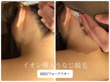 リノ(Lino)/うなじ脱毛シェービング付♪