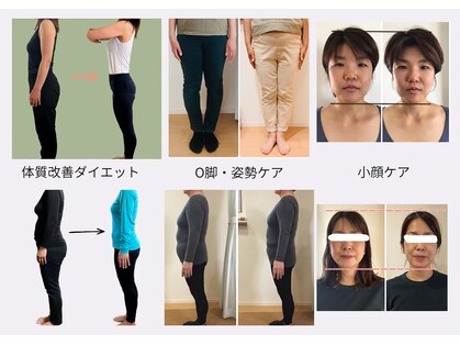 わたしのの写真