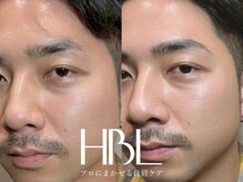 エクラ(Eclat)/HBL/ハリウッドブロウリフト