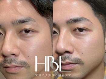 エクラ(Eclat)/HBL/ハリウッドブロウリフト