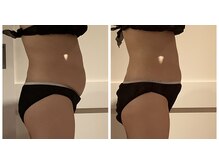 プリヴィエレジェ(privilegie)/ハイパーナイフ1回コース