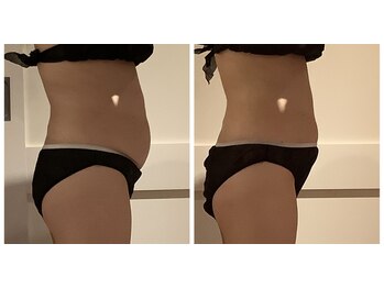 プリヴィエレジェ(privilegie)/ハイパーナイフ1回コース