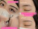 スイートブリンク(Suite blink)の写真