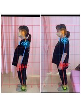 マイティー整骨院 ココア(CoCoa)/姿勢改善