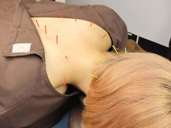 一樹鍼灸院の写真/信頼の技術で、辛い首肩のコリを根本から解消！施術後のスッキリ感が違う！腰痛・背中等のお悩みの方にも◎