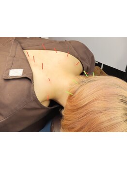 首・肩のつらさを改善したい