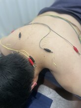 高崎カラダサポート鍼灸接骨院/電気を使って鍼灸施術