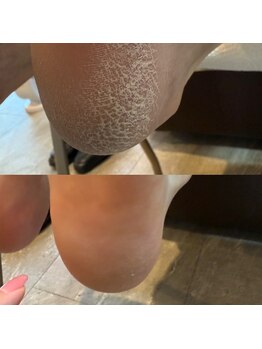 ウェルズユキ(well's yuki)/