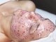 ブラジリアンワックス脱毛サロン アンベリール(Embellir)の写真/大人気の毛穴洗浄とフェイスWAXのダブル施術で毛穴汚れや毛穴の黒ずみを徹底除去◎つるんと整った美肌へ♪