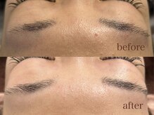 サロン エム(saron M)/お客様ビフォーアフター