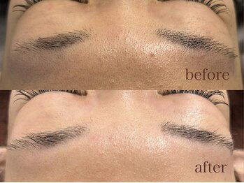 サロン エム(saron M)/お客様ビフォーアフター