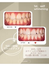 スリール(sourire)/