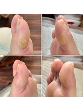 ドクターネイル爪革命 富山店/