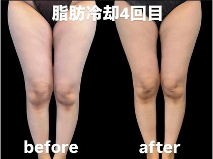 ソライロの写真