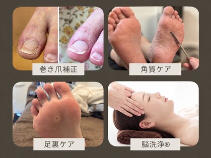ウィローの写真
