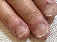 ネイルサロンアンドスクール シーグリーン(SEAGREEN)/【お悩み事例】手荒れのお悩み