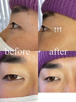 レガオスビューティー(Regaos_Beauty)/逆さまつ毛のお悩み