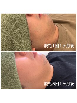 フームー シム(fuumuu Shim)/着実に変化を実感!