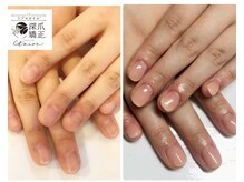 トイロ(toiro)/爪のコンプレックスも解消！