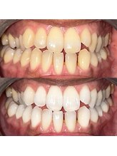 ライトビューティー 池袋店(LightBeauty)/症例写真