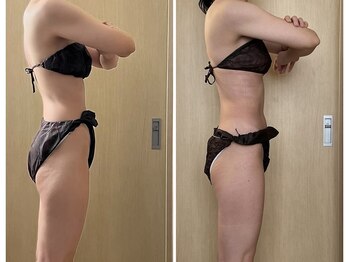 マイティー整骨院 ココア(CoCoa)/セルクラ