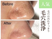 グラシーズ(Glasses)/毛穴洗浄で小鼻の黒ずみすっきり