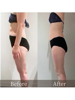 インフィニーズ(INFINEEZ)/カスタマイズ120分美容整体50代