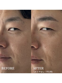 エース(ACE.)/眉毛で変わる第一印象☆