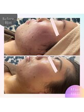 ビューティサロン ベルティア(Beltia)/#ダイエット#痩身#ブライダル