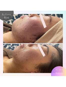 ビューティサロン ベルティア(Beltia)/#ダイエット#痩身#ブライダル