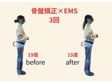 リボーン(REBORN)/整体/骨盤矯正/EMS