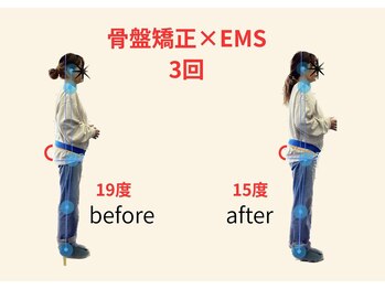リボーン(REBORN)/整体/骨盤矯正/EMS