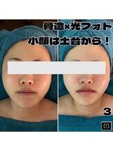 アンドワイ バイ サロンリーナ(&y by Salon Lena)/【コルギを超えたコルゾウ×光】