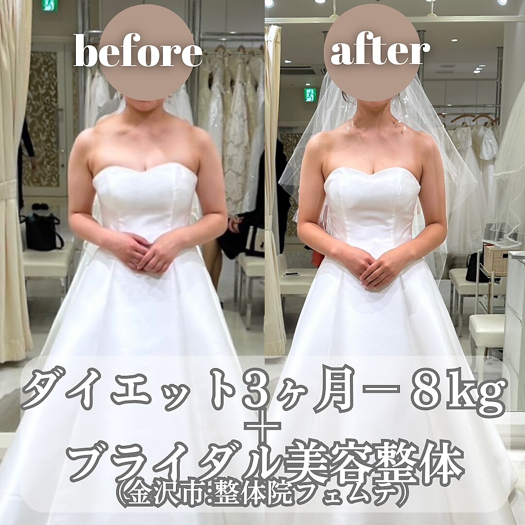 体重＋姿勢を同時に整えたい花嫁様【ダイエット＋ブライダルエステ美容整体】