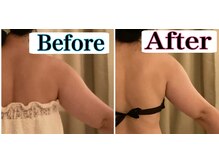 トータルビューティーサロン 凛/二の腕にダイレクトアプローチ