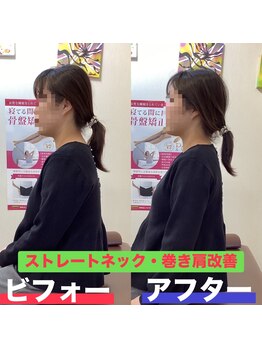 ヒデ整体院(Hide整体院)/産後骨盤矯正で歪み腰痛開き改善