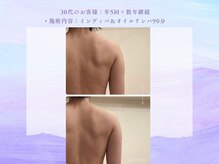 サロン タエン/華奢見え背中すっきりインディバ