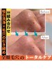 【新メニュー】おすすめNO.１/全顔毛穴トータルケア（吸引×毛穴引締）