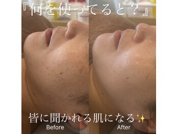 エレナ(Elena)/陶肌トリートメント