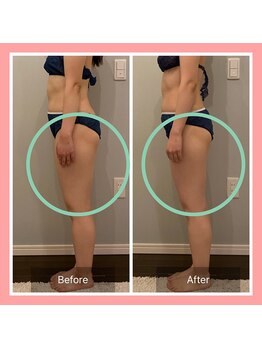 ヨサパーク ミュゲ(YOSA PARK Muguet)/痩身/ダイエット/リンパ/産後