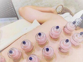 ひのき酵素浴サロン ホッコリーナ(hoccorena)の写真/大好評の「全身カッピングコース」をお二人で♪　血流を促進し、首肩コリ・慢性疲労などの改善にも効果的◎